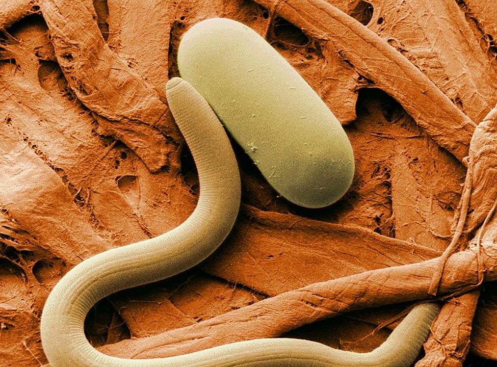 come avviene l'infestazione da vermi