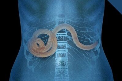 Parassiti nel corpo umano