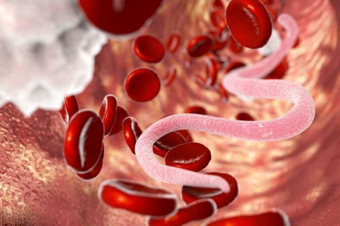 Analisi per determinare gli elminti