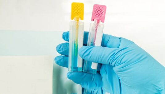 Metodi di diagnostica del parassita